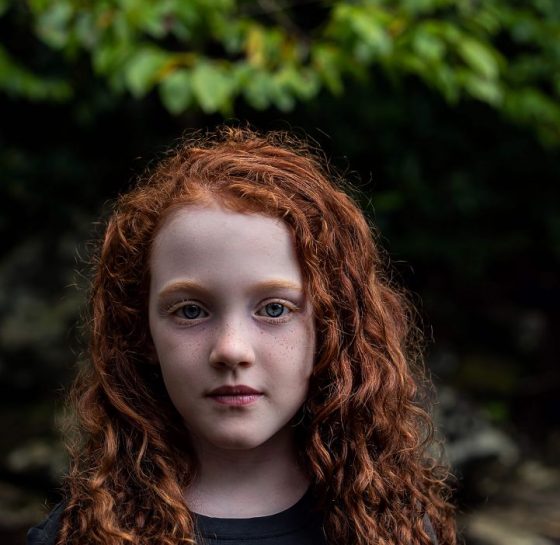 Why are many redheads in Ireland? | Ireland Chauffeur Travel
